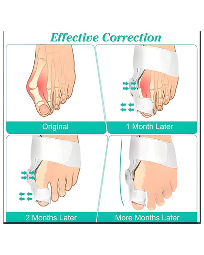 MacMonte™ | Toe Corrector for Natural Alignment